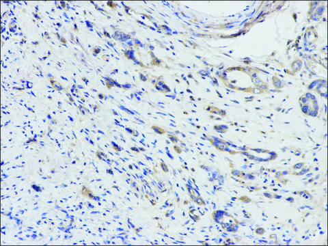 Anti-DPYD antibody produced in rabbit