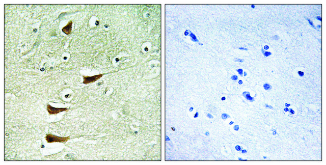 Anti-MAP3K10 antibody produced in rabbit