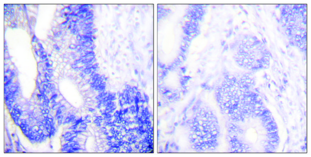Anti-Claudin 3 antibody produced in
