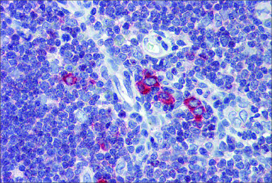 Anti-TFR2 (ab1) antibody produced in