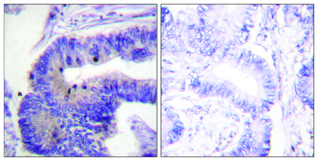 Anti-PDE4D antibody produced in rabbit