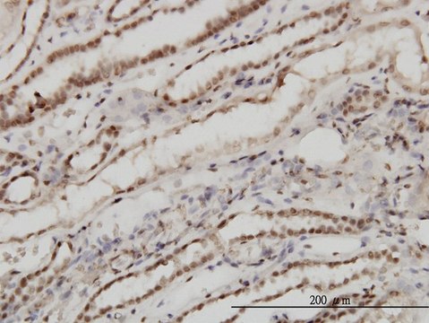 Monoclonal Anti-TSG101 antibody produced in
