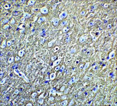 Anti-LMX1B antibody produced in rabbit