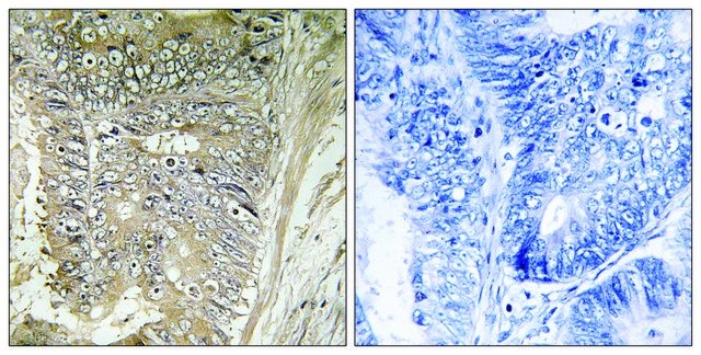 Anti-RPL37A antibody produced in rabbit