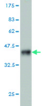 Monoclonal Anti-NEK4, (C-terminal) antibody produced