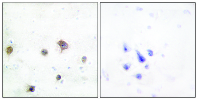 Anti-JIP2 antibody produced in rabbit