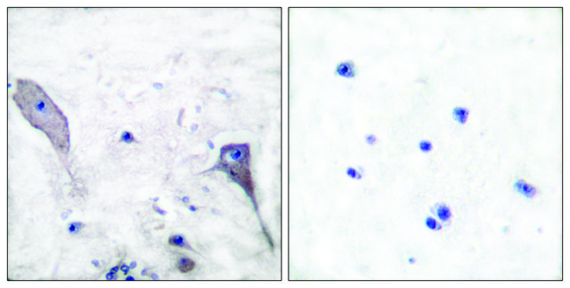 Anti-PATCHED, N-Terminal antibody produced in