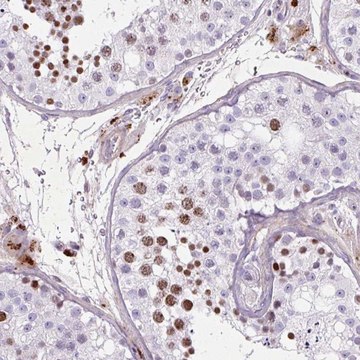 Anti-SPC24 antibody produced in rabbit