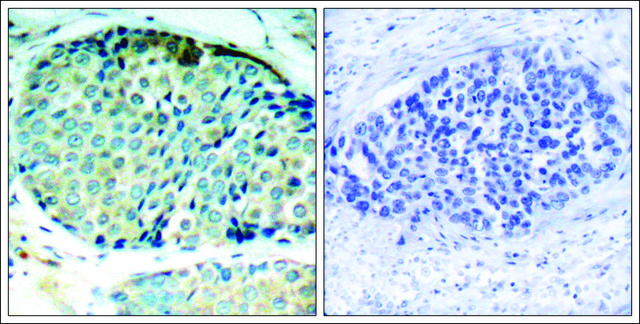 Anti-phospho-HSPB1 (pSer??) antibody produced in