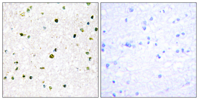 Anti-AKAP11 antibody produced in rabbit