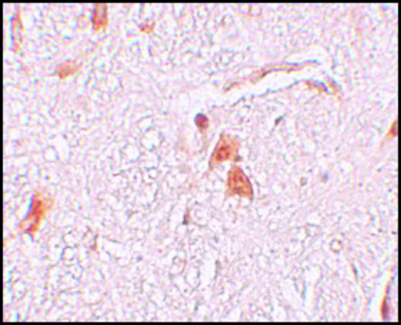 Anti-SHISA9 antibody produced in rabbit