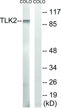 Anti-TLK2 antibody produced in rabbit