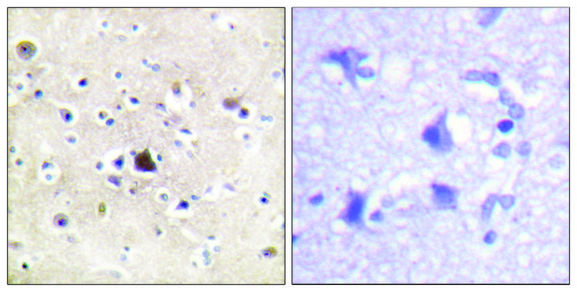 Anti-GR antibody produced in rabbit