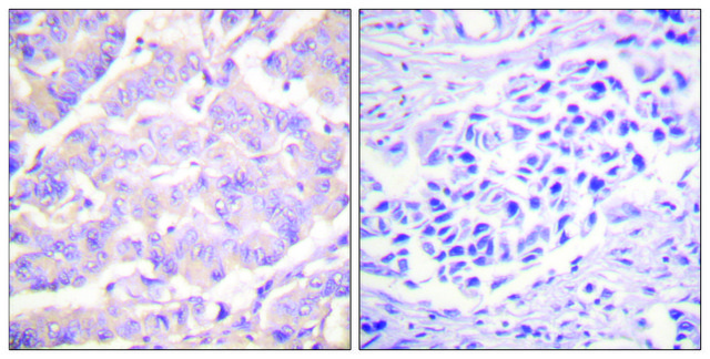 Anti-C-PLA2 antibody produced in rabbit