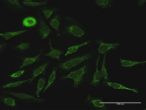 Anti-PDK4 antibody produced in rabbit