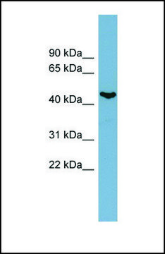 Anti-IRX6, (N-terminal) antibody produced in