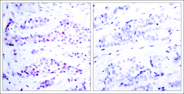 Anti-STAT6 (Ab-641) antibody produced in