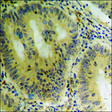 Anti-phospho-ASK1 (pSer???) antibody produced in