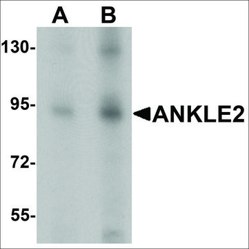 Anti-ANKLE2 antibody produced in chicken