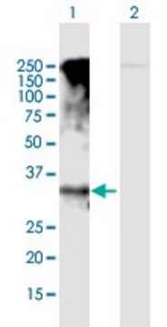 Anti-GPRC5D antibody produced in mouse