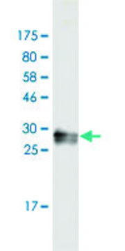 Monoclonal Anti-GNRHR2, (C-terminal) antibody produced