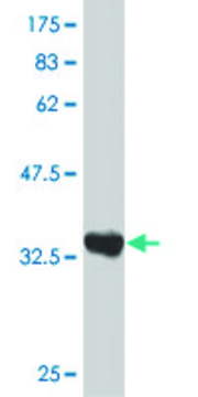 ANTI-ZIC3 antibody produced in mouse