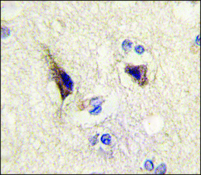 Anti-NTF3 (center) antibody produced in