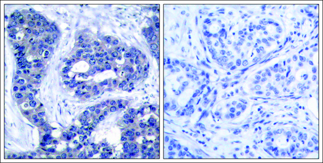 Anti-phospho-IRS1 (pSer?³?) antibody produced in