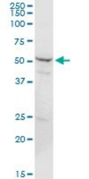 Anti-PSMD5 antibody produced in rabbit