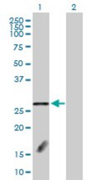 Anti-FBXL18 antibody produced in rabbit