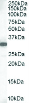 Anti-MCL1 (Isoform 1) antibody produced