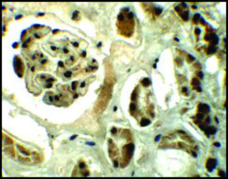 Anti-REQUIEM antibody produced in rabbit