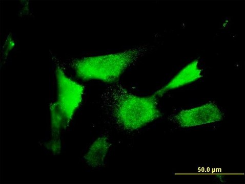 Monoclonal Anti-ASAHL antibody produced in