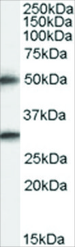 Anti-SPINESIN/TMPRSS5 antibody produced in goat