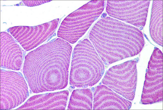 Anti-FABP3 (ab2) antibody produced in