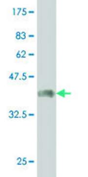 Monoclonal Anti-CER1 antibody produced in