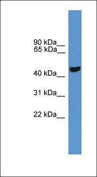 Anti-PARK2 antibody produced in rabbit