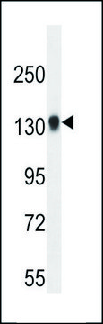 ANTI-TDRD7 (C-TERM) antibody produced in
