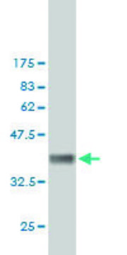 ANTI-FHIT antibody produced in mouse