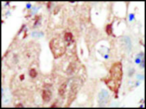 Anti-PI3KR2 (C-term) antibody produced in