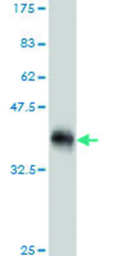 ANTI-ULK2 antibody produced in mouse