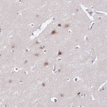 Anti-ACTR3 antibody produced in rabbit