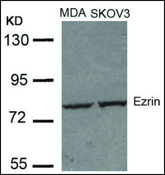 Anti-EZR (Ab-353) antibody produced in
