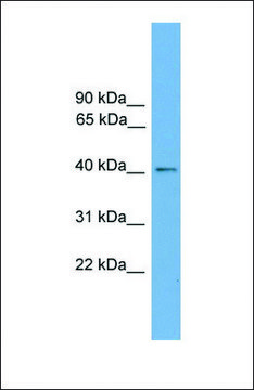 Anti-ZDHHC18 antibody produced in rabbit
