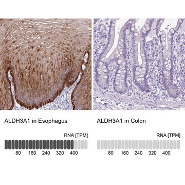 Anti-ALDH3A1 antibody produced in rabbit