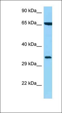 Anti-HLA-C antibody produced in rabbit