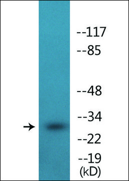 Anti-phospho-IL-2R ?/CD25 (pSer²??) antibody produced