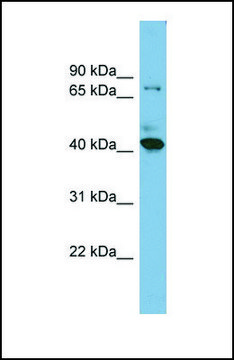 Anti-HERPUD2, (N-terminal) antibody produced in