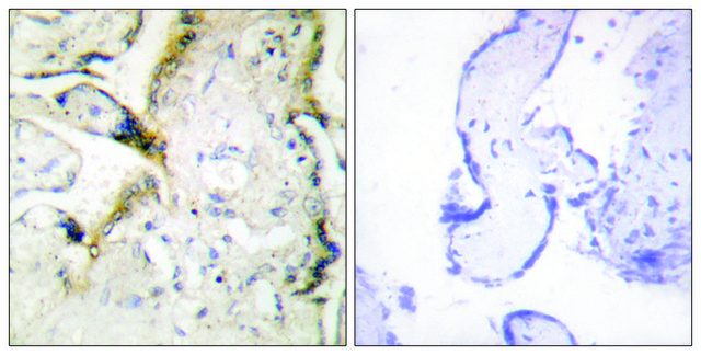 Anti-LAMA2 antibody produced in rabbit