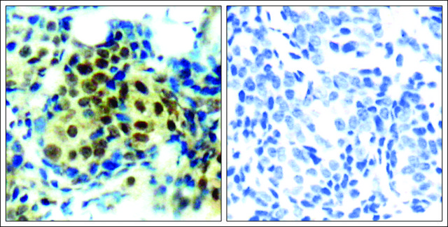 Anti-phospho-MAPK3 (pThr²?²) antibody produced in